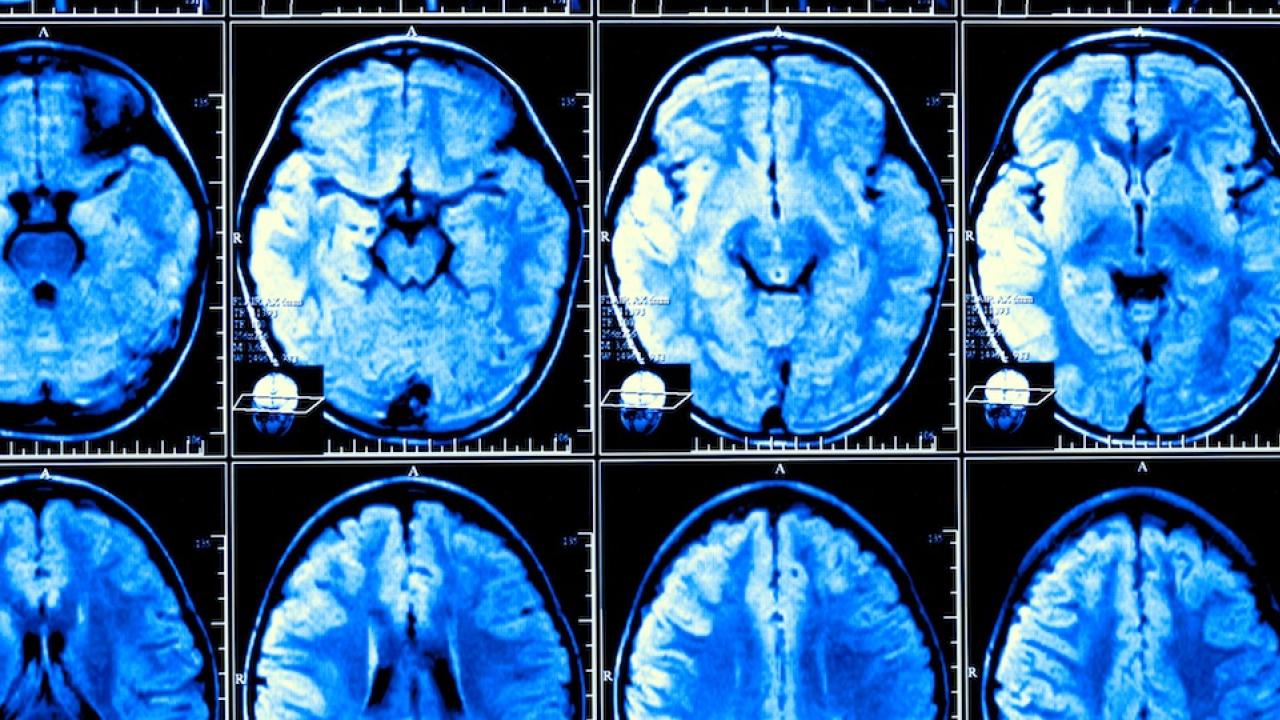 An x-ray of 10 brains showing different sized brains