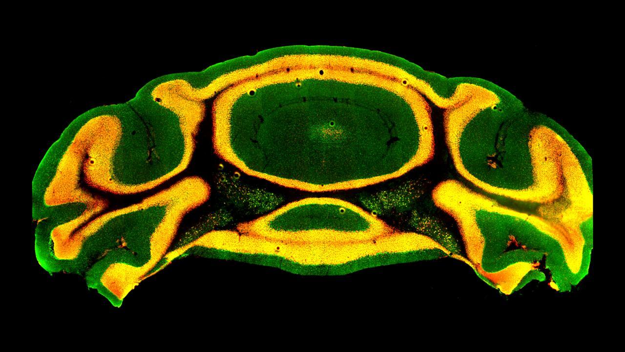 Shown here is the cross section of a mouse cerebellum, with orange fluorescence revealing nerve cells that express Chd8. (Se Jung Jung, Fioravante lab / UC Davis)