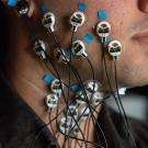 Close-up of a participant’s face and neck with multiple electrodes attached using blue medical tape. The electrodes are connected to thin black wires, leading to a monitoring device, highlighting a scientific study on muscle or nerve activity
