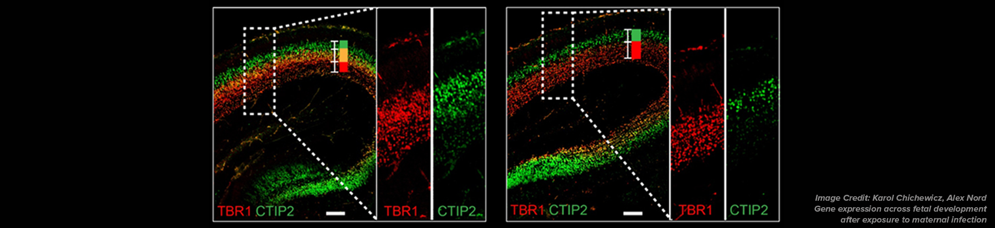 Gene expression across fetal development following exposure to maternal infection