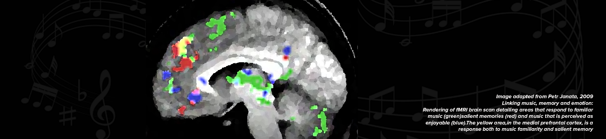 fMRI brain scan taken while participants listened to music