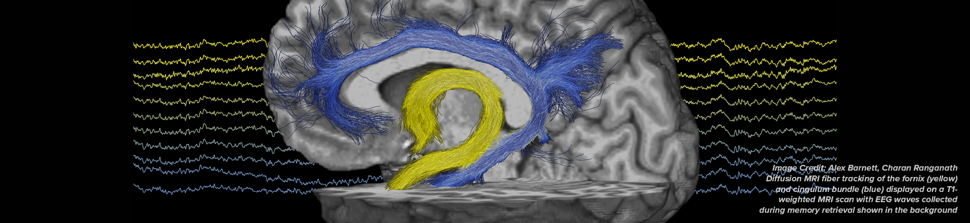 Diffusion MRI fiber tracking displayed on a T1 weighted MRI scan over EEG waves collected during memory retrieval