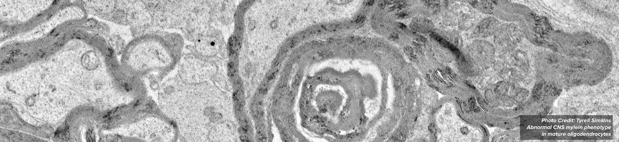 Abnormal CNS myelin phenotype in mature oligodendrocytes captured by electron microscopy