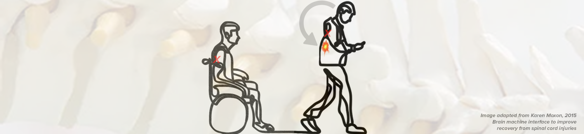 Continuous line drawing of man going from wheel chair to walking following spinal stimulation 